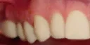 nadinhead2010_teeth_lower