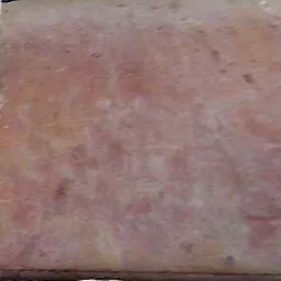 mus2