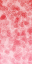 tubelite