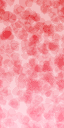 tubelite